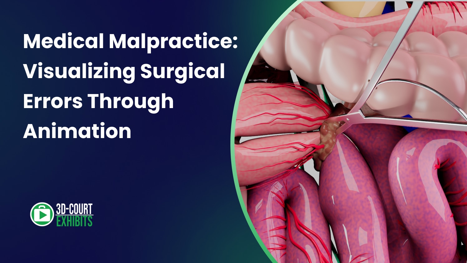 Medical malpractice thumbnail