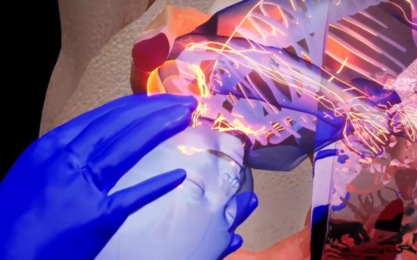 Birth injury medical malpractice